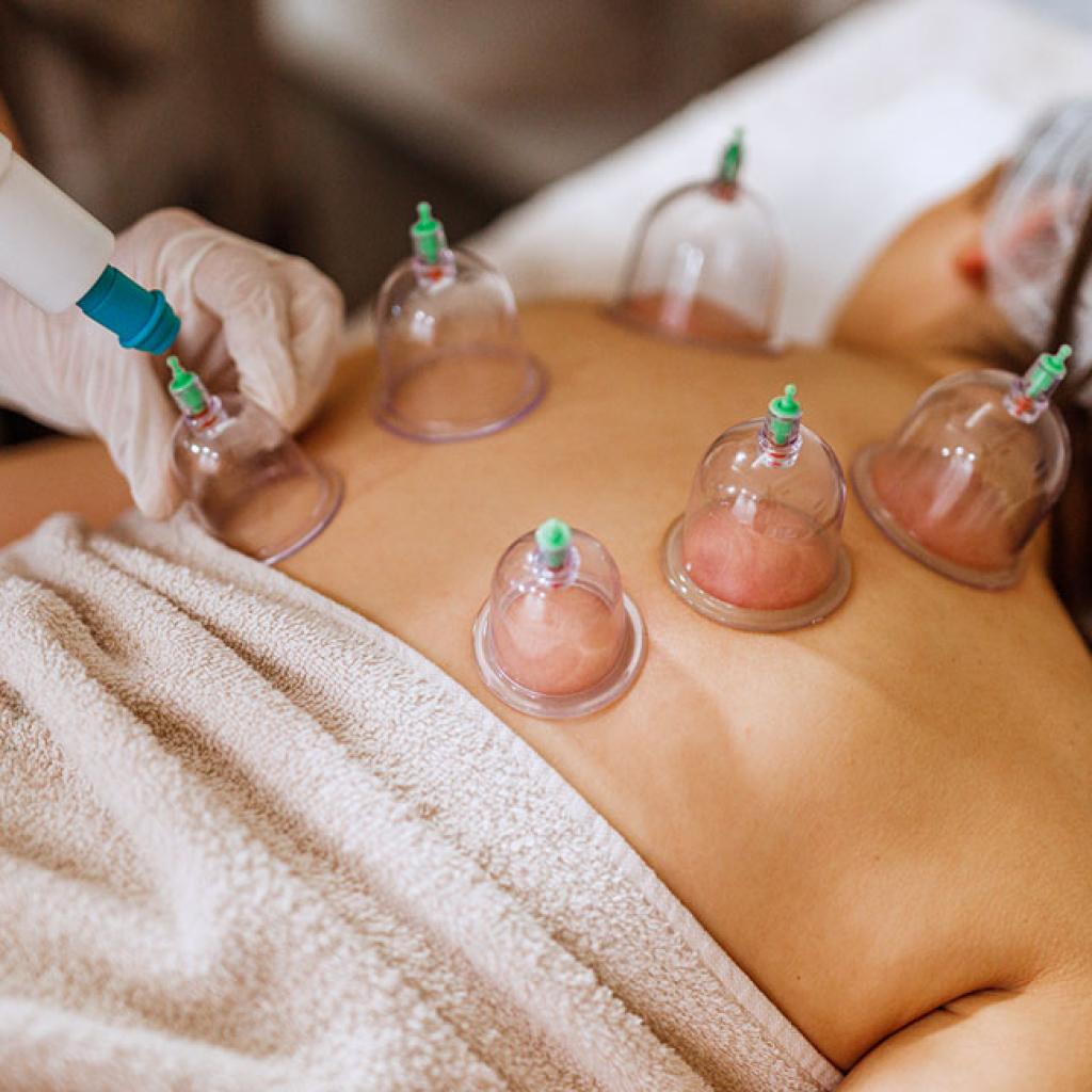 Full Body Cupping