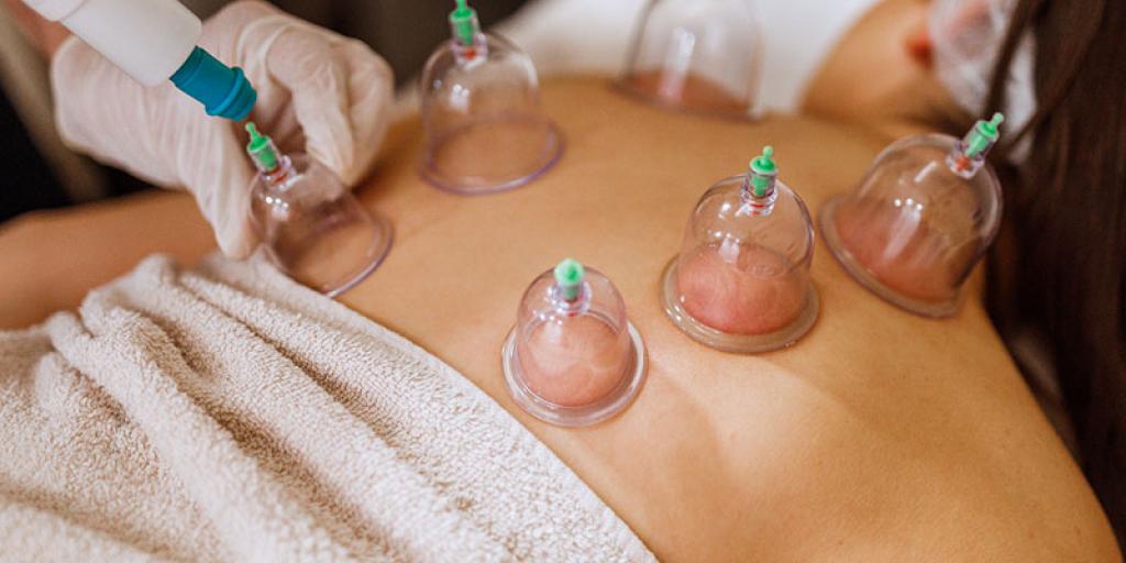 Full Body Cupping