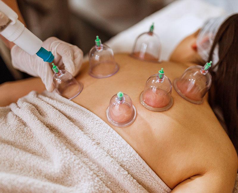 Full Body Cupping