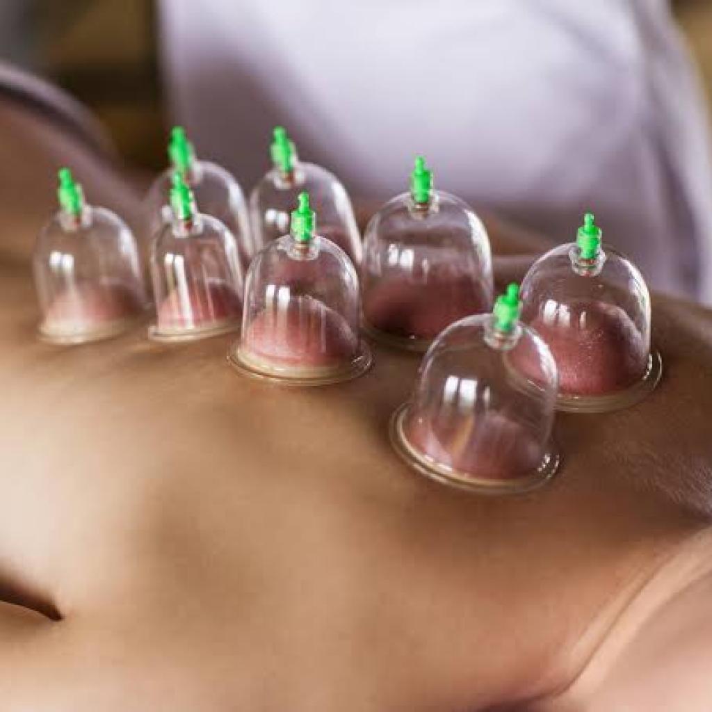 Half Body Cupping