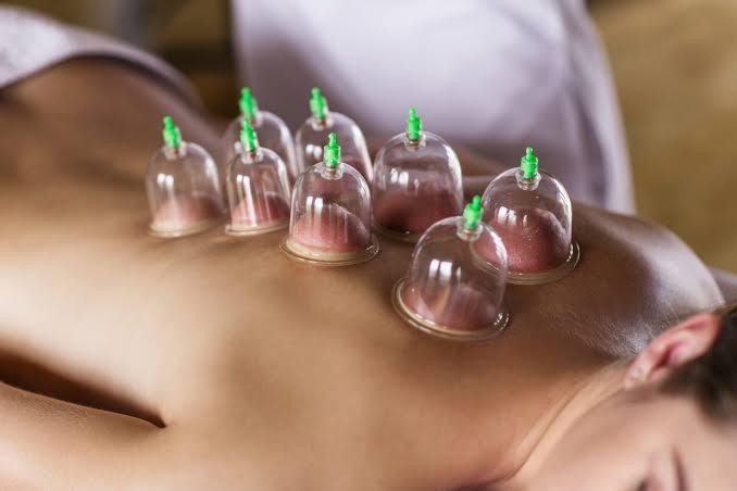 Half Body Cupping