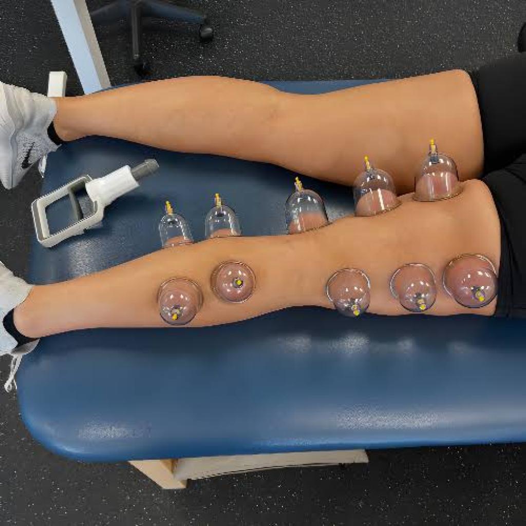 Legs & Neck Cupping