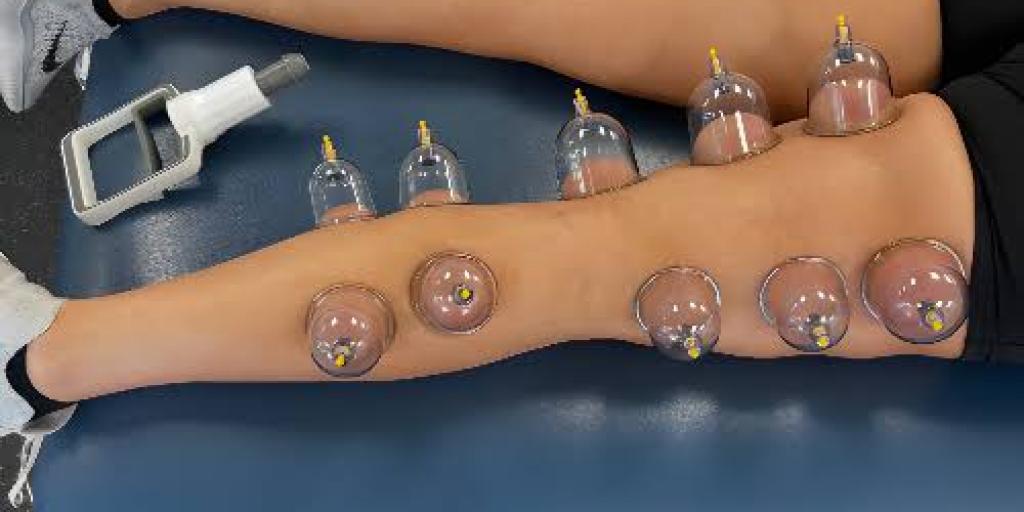 Legs & Neck Cupping